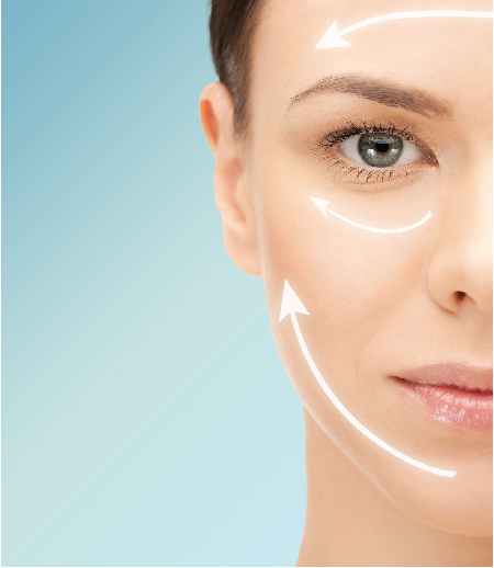 endolift2